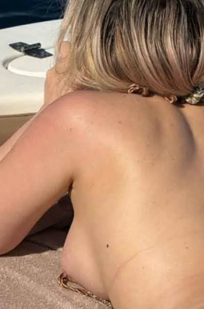 Camilla, 34 år